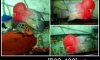 �١������ ᴧ�ء ��´� (�������Ҥ�����Ѻ)